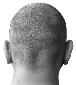 bald-head-1-574667-m